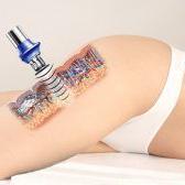 Formation en ligne sur la cavitation à 40 kHz